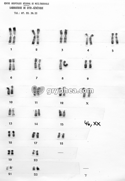 Caryotype classé 46, XX - gryphea.org